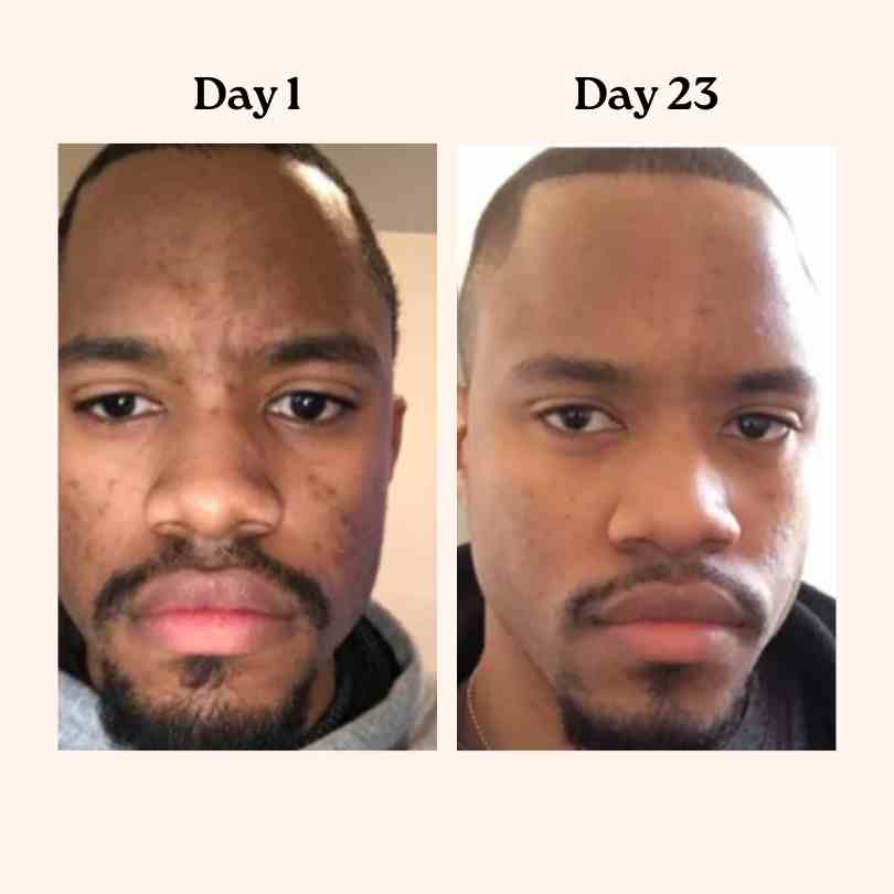 Vitaly Beef Tallow Honey Balm